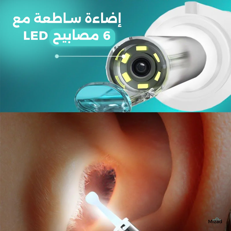 جهاز منظف الأذن الذكي مع كاميرا بدقة FHD